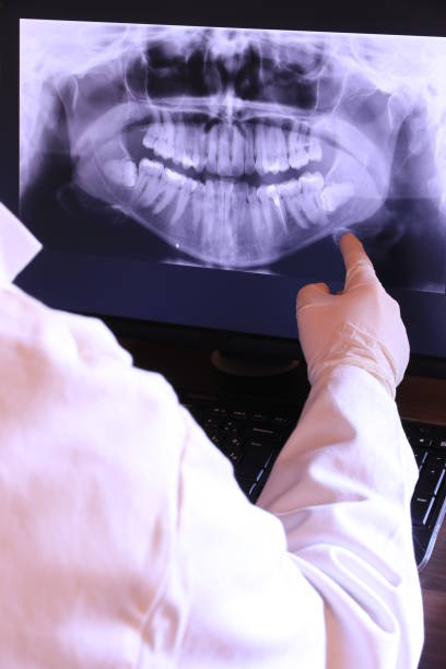Best Emergency Dentist for Lost Fillings or Crowns in Muncie, IN